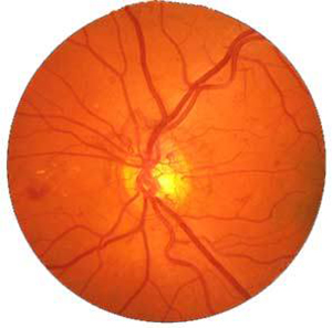 ABQ-Eye-Care-Digital-Retina-Scan